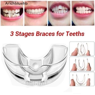 < Arichbluehb > Đai Nẹp Chỉnh Hình Răng Chăm Sóc Răng Miệng
