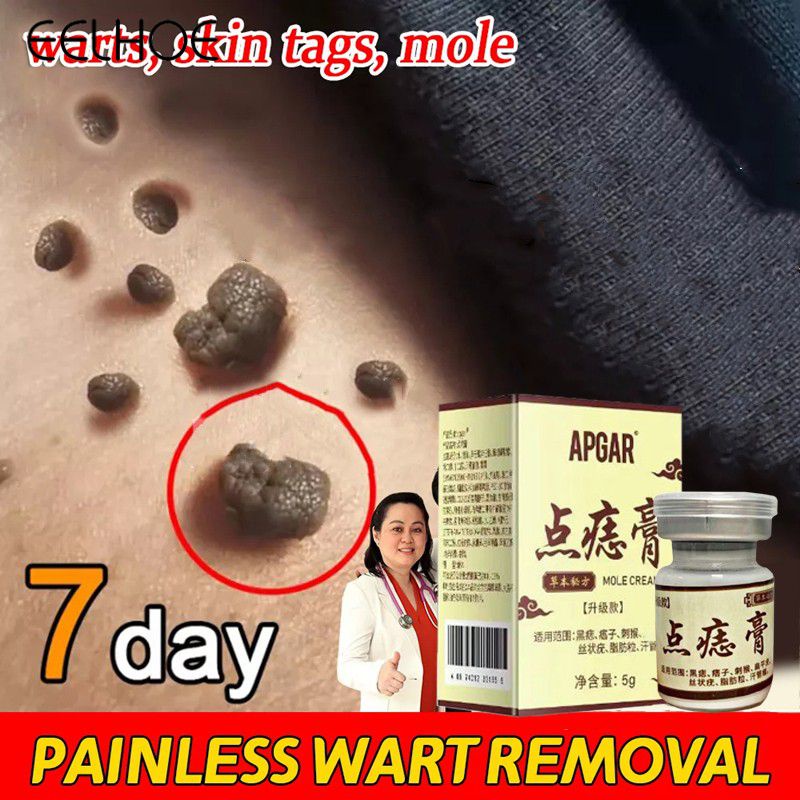Ảnh Kem tẩy nốt ruồi dạng đặc EELHOE Apgar loại bỏ da chết hỗ trợ giảm mụn cóc hiệu quả mạnh 1