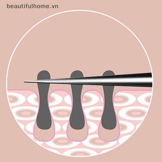Nhíp 8cm để chiết xuất mụn đầu đen để làm đẹp