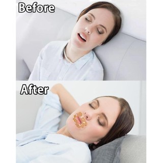 BAMBOOB 30 băng dán miệng vải không dệt hỗ trợ thở, cải thiện giấc ngủ, giảm ngáy