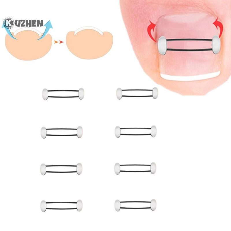 KUZHEN Dụng cụ chỉnh sửa móng mọc ngược chân, phục hồi, kẹp thẳng, nẹp điều trị, HOT