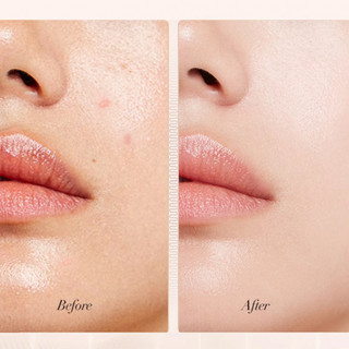 Uodo Liquid Foundation Kem Che Khuyết Điểm Dưỡng Ẩm Lâu Dài Không Trang Điểm Hỗn Hợp Khô Dầu Da Mặt Trang Điểm 30ml
