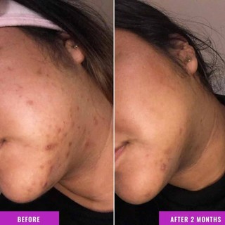Good Molecules Discoloration Correcting Serum 30ml – Brighten & Even Skin Tone