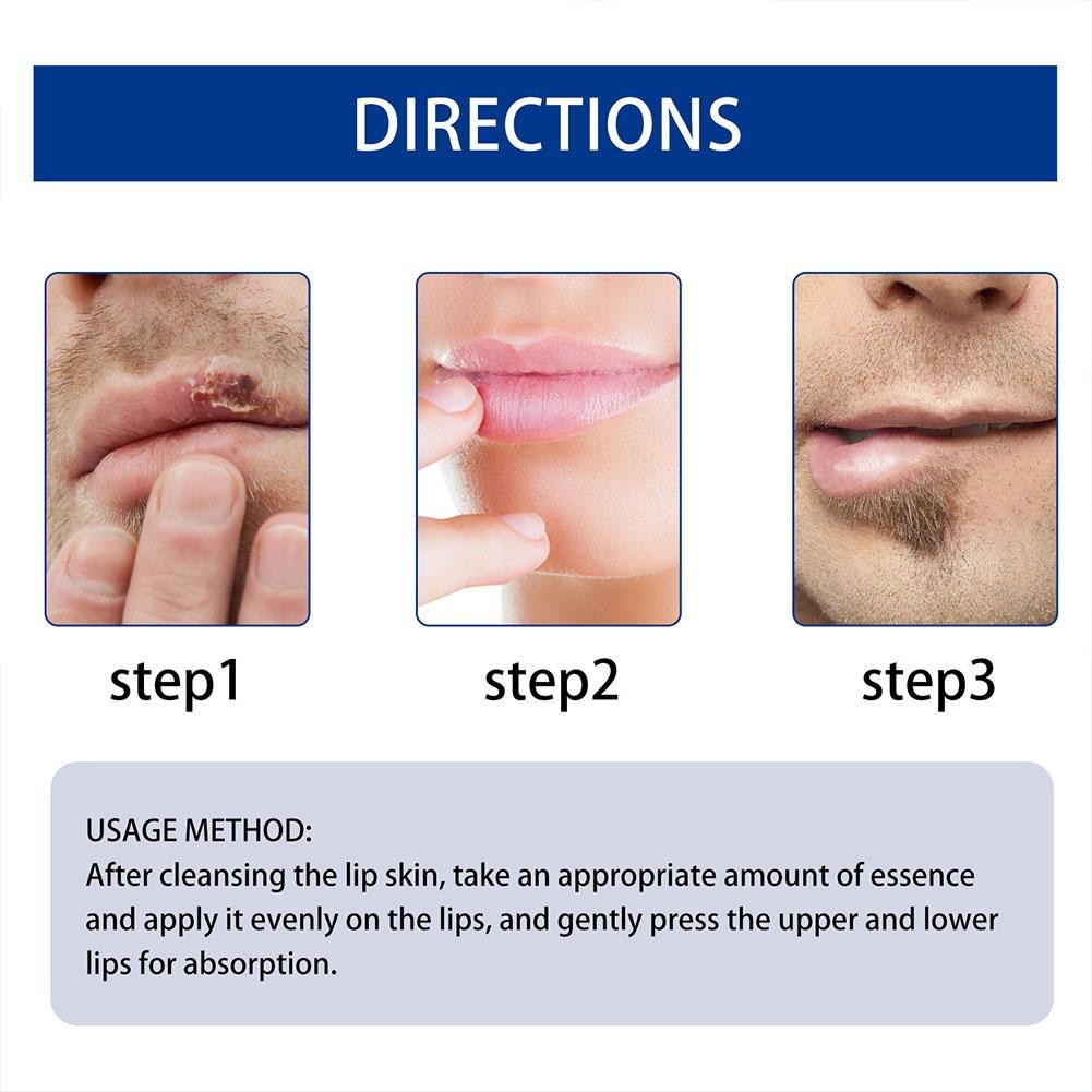 LEARNEVER Lip Serum Dành Cho Nam Dưỡng Ẩm Và Bảo Vệ Môi Khô Chapped & Dark Lip Essence Roll-on Lip Care R6h7