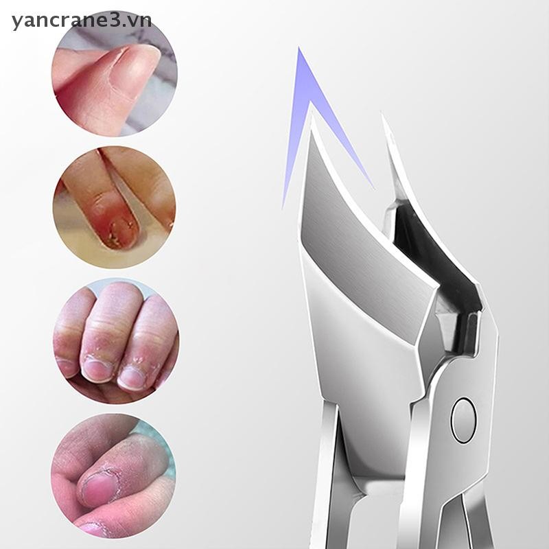 {YAN} Tông đơ cắt móng tay cong Chống bắn tỉa Tông đơ cắt móng tay mở rộng đặc biệt Kìm chéo Kéo cắt móng tay Dụng cụ làm móng tay {ya}