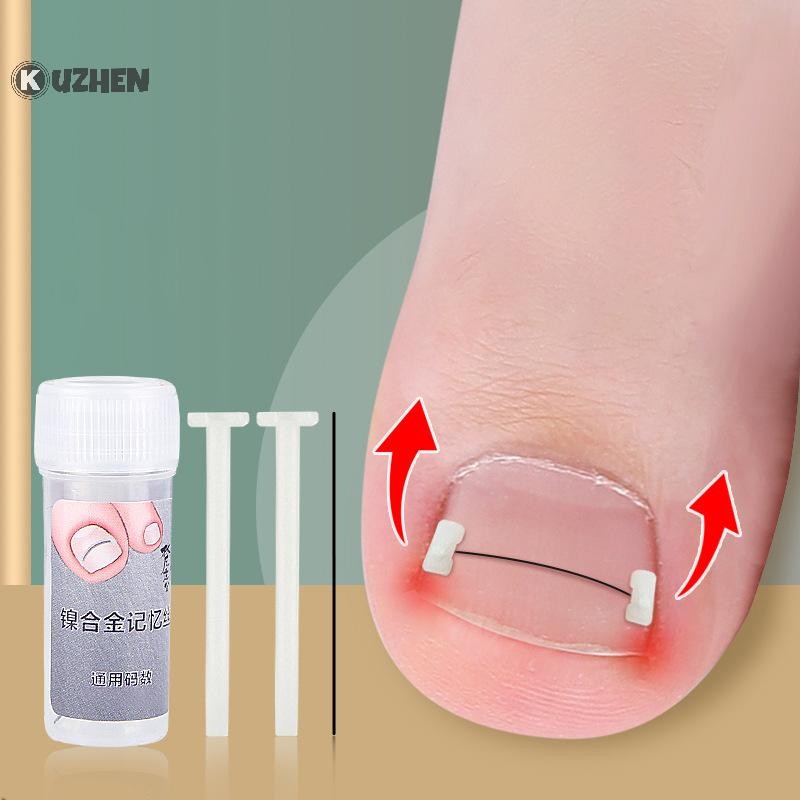 KUZHEN Công cụ chỉnh sửa móng mọc ngược, phục hồi móng, nhúng ngón chân, điều trị móng mọc ngược HOT Chăm sóc bàn chân