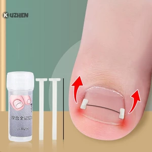KUZHEN Công cụ chỉnh sửa móng mọc ngược, phục hồi móng, nhúng ngón chân, điều trị móng mọc ngược HOT Chăm sóc bàn chân