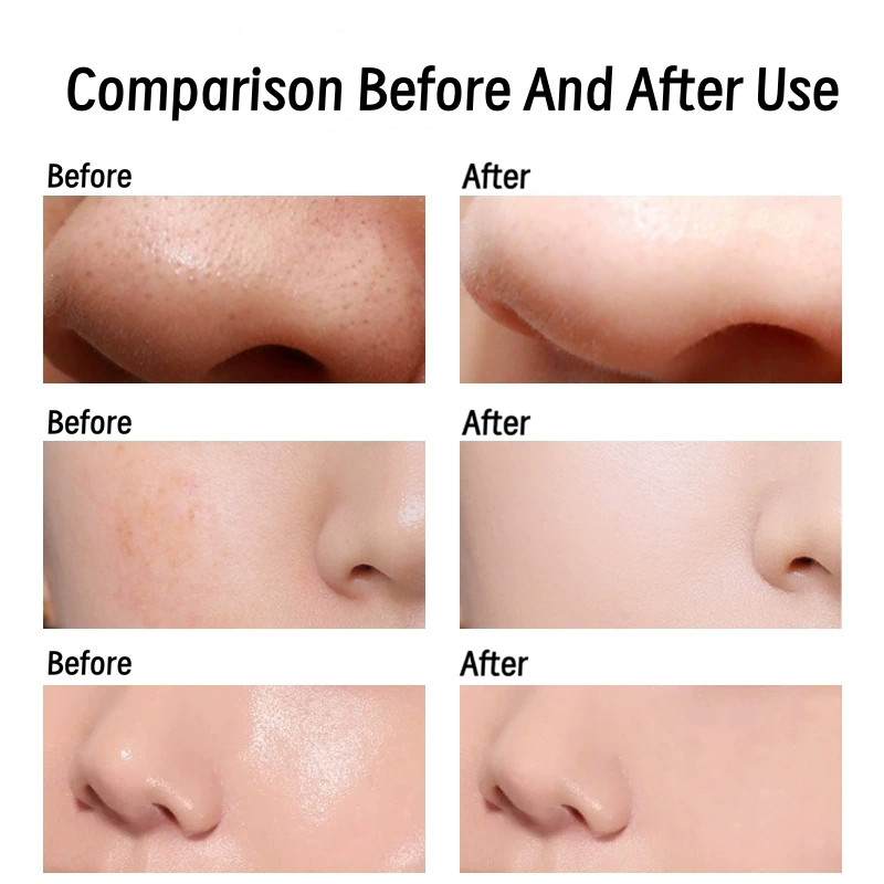 5 / 10 Chiếc Loại Bỏ Mụn Đầu Đen Miếng Dán Mũi Rách T Khu Vực Điều Dưỡng Khoáng Bùn Mũi Mặt nạ Làm Sạch Sâu Dụng Cụ Làm Đẹp