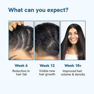 Be Bodywise Hair Growth Roll-On Serum Nourishes & Strengthens Hair Reduces Hair Fall 25ml