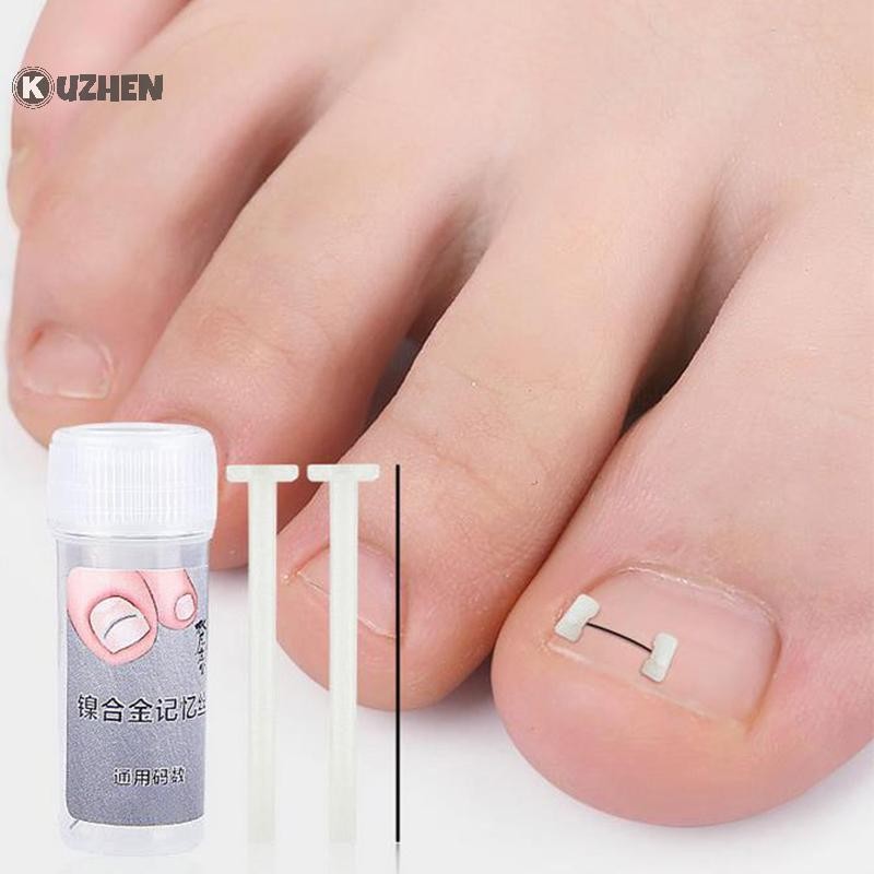 KUZHEN Công cụ chỉnh sửa móng mọc ngược, phục hồi móng, nhúng ngón chân, điều trị móng mọc ngược HOT Chăm sóc bàn chân
