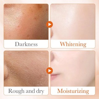 RISEDOT Vitamin C Serum, Công thức hấp thụ nhanh 5 trong 1 Hydrating, Radiance Complexion pH Cân bằng Chất chống oxy hóa Phong phú Kết cấu nhẹ Giảm thiểu lỗ chân lông nhạy cảm An toàn cho da