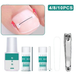 HORK Dụng cụ nẹp móng chân mọc ngược, phục hồi móng, kẹp chỉnh móng, nẹp ngón chân VN