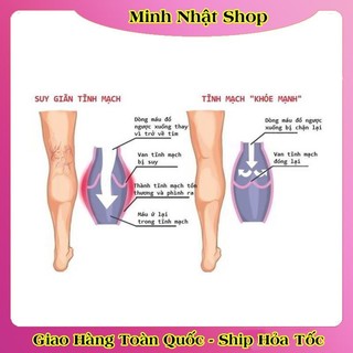 Kem Bôi  giãn tĩnh mạch Abtei Venen Aktiv 125ML của Đức - Date mới Đủ Bill