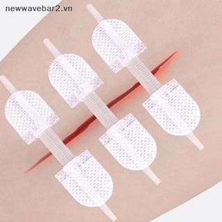 [Mới] Dây đeo Dây kéo Miếng dán đóng vết thương Dây kéo co giãn thoáng khí Băng dính để hỗ trợ nẹp chăm sóc vết thương.