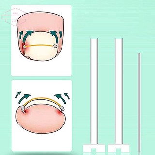 HORK Dụng cụ nẹp móng chân mọc ngược, phục hồi móng, kẹp chỉnh móng, nẹp ngón chân VN