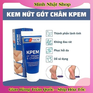 [ DATE MỚI] Kem Giảm Và Phục Hồi Nứt Nẻ Gót Chân Kpem 50ml của Nga