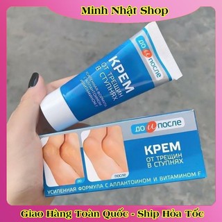 [ DATE MỚI] Kem Giảm Và Phục Hồi Nứt Nẻ Gót Chân Kpem 50ml của Nga