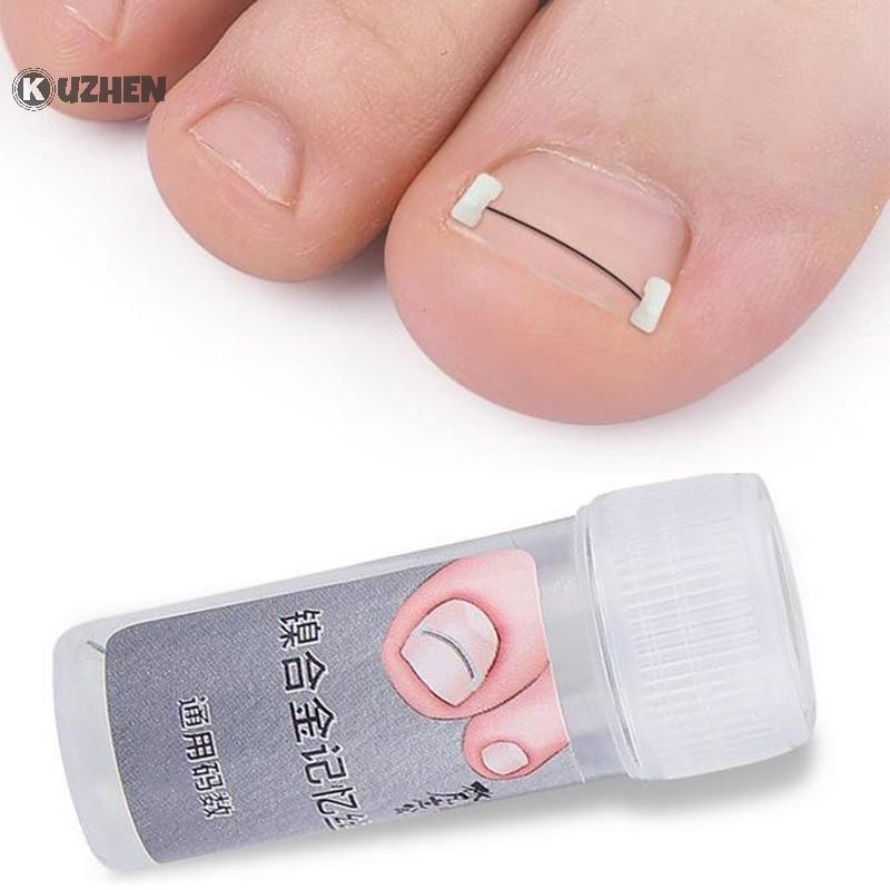 KUZHEN Công cụ chỉnh sửa móng mọc ngược, phục hồi móng, nhúng ngón chân, điều trị móng mọc ngược HOT Chăm sóc bàn chân