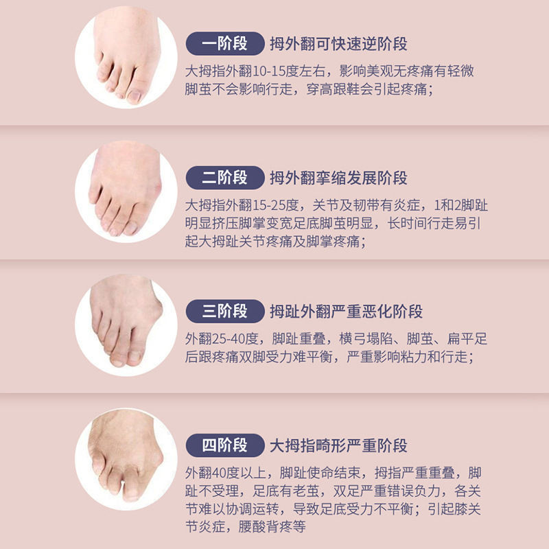 Máy tập chân Arch Trainer, chỉnh sửa lòng bàn chân và ngón chân, cải thiện chứng Hallux Valgus, thiết bị làm đẹp bắp chân FVXN