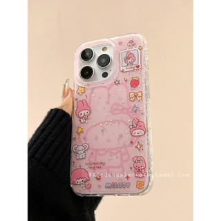 Ốp điện thoại Star Melody màu hồng dễ thương phù hợp cho iPhone 16 15 14 13 Pro Max chống sốc bảo vệ camera chống rơi mặt sau cứng