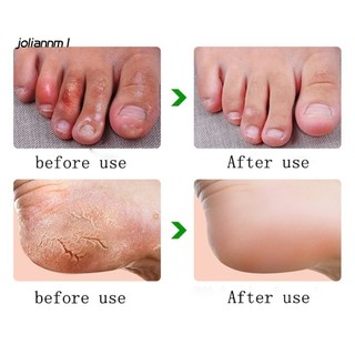 Kem Dưỡng Ẩm Chống Nứt Nẻ Da Tay Chân 88g