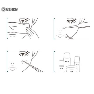 Kuzhen Kẹp Nhíp Gắp Mụn Đầu Đen Làm Đẹp Bọ Chét Đặc Biệt
