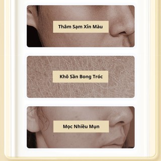 Tinh Chất Vitamin E Dưỡng Ẩm Sáng Da Ngăn Ngừa Mụn Và Loại Bỏ Nếp Nhăn Vùng Da Thâm Sạm