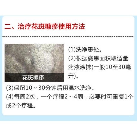 150g Dầu gội Selenium Disulfide Tẩy da đầu, chống ngứa, viêm da tiết bã, đốm mồ hôi.