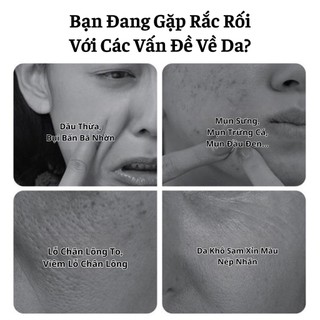 Gel Tía Tô Dưỡng Ẩm TrắngDa Loại Bỏ Bụi Bẩn Bã Nhờn Ngăn Ngừa Mụn Tẩy Đi Mọi Loại Da Chết 120g