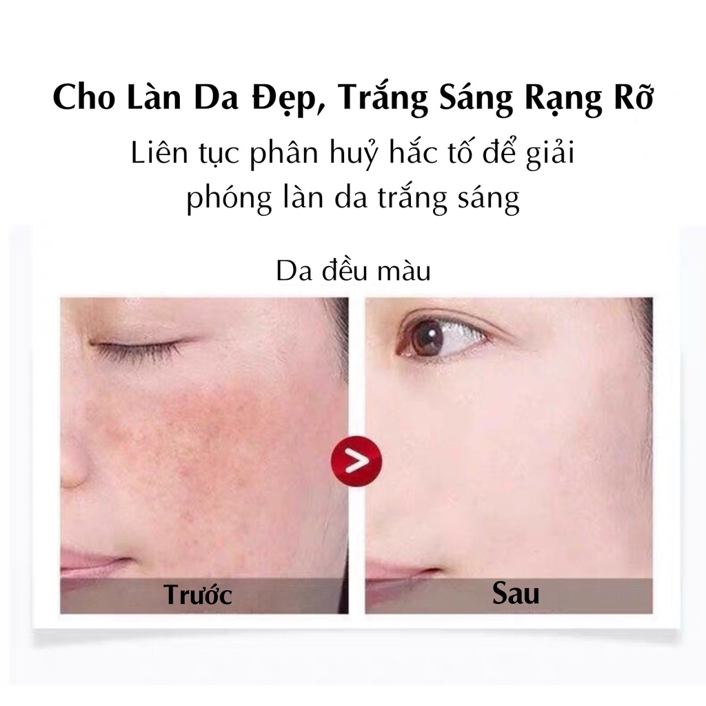 Tinh Chất Yan Chunxi Doumeiren Dưỡng Trắng Da, Loại Bỏ Nám, Tàn Nhang, Dưỡng Ẩm, Làm Đều Màu Da, Phục Hồi Da Từ Sâu Bên