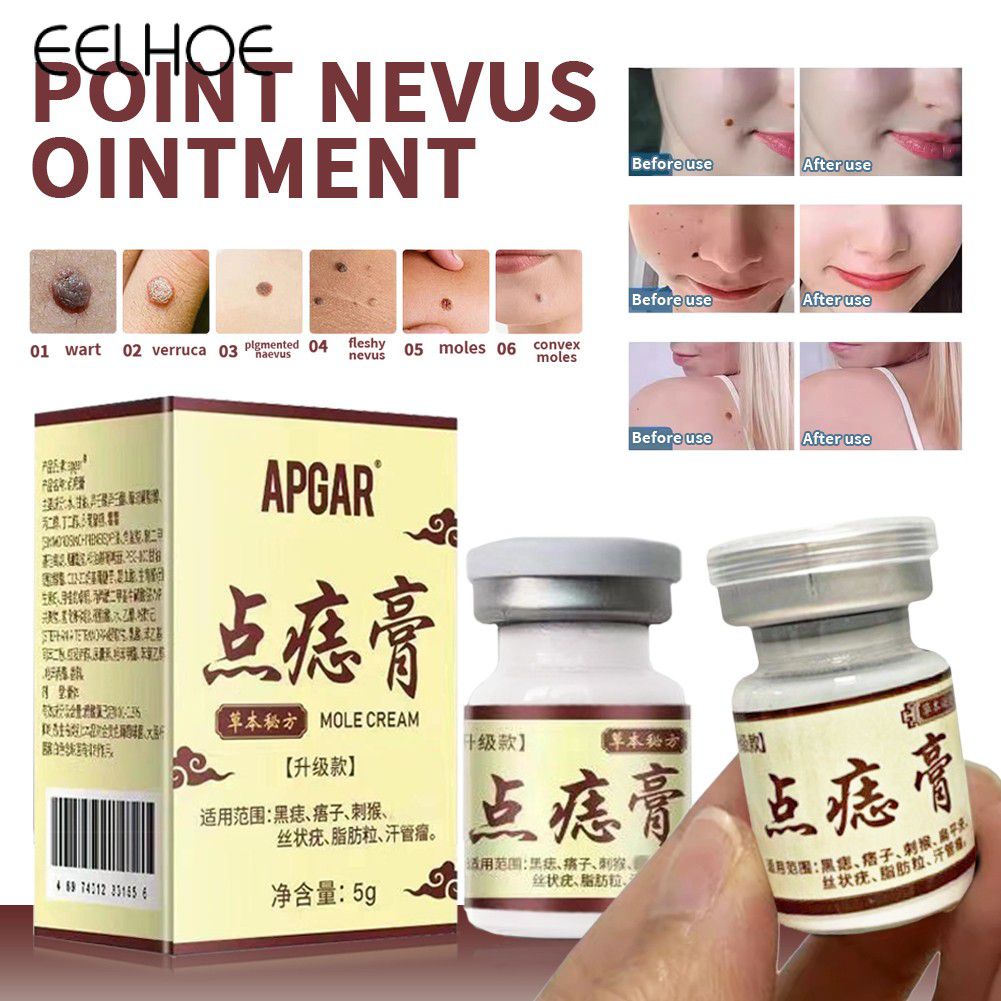 Ảnh Kem tẩy nốt ruồi dạng đặc EELHOE Apgar hỗ trợ giảm mụn cóc hiệu quả mạnh 1