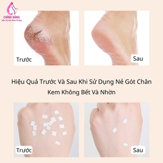 Combo 5 Lọ Kem Hết Nứt Nẻ Da Chân Tay Miệng Dưỡng Ẩm Mịn Ngay Sau Khi Thoa 20g