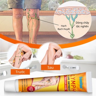 Kem Bôi Hết Nổi Hạch Sưng Phù Bạch Huyết, Ngăn Ngừa Đau Nhức Và Lưu Thông Máu