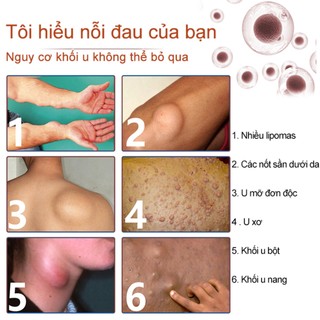 Kem Đánh Tan U Mỡ Hiệu Quả Thẩm Thấu Nhanh Phục Hồi Bề Mặt Da Nhanh Chóng