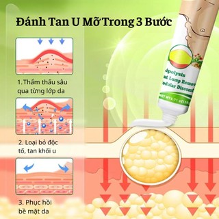 Kem Đánh Tan U Mỡ Hiệu Quả Thẩm Thấu Nhanh Phục Hồi Bề Mặt Da Nhanh Chóng