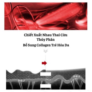 Chính Hãng Bộ Tế Bào Gốc Hàn Quốc Tinh Chất Dưỡng Ẩm, Hết Nhăn Mờ Thâm Và Tái Tạo Làn Da 60 Tuýp