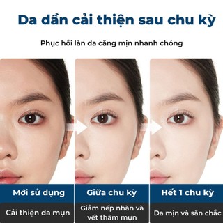 BỘ SERUM BỘT ĐÔNG KHÔ DƯỠNG DA MẶT LOẠI BỎ MỤN VẾT THÂM MỤN VẾT NHĂN TRÊN DA. TÁI TẠO LÀN DA TRẺ ĐẸP