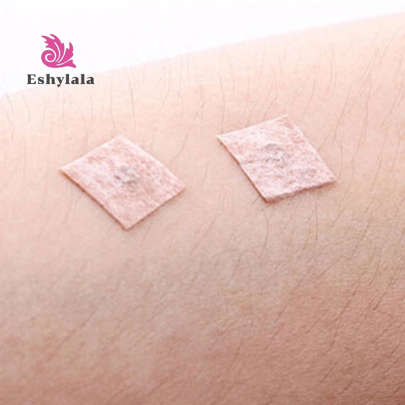 100 cái / hộp kim châm cứu dùng một lần cho da tai [MỚI]