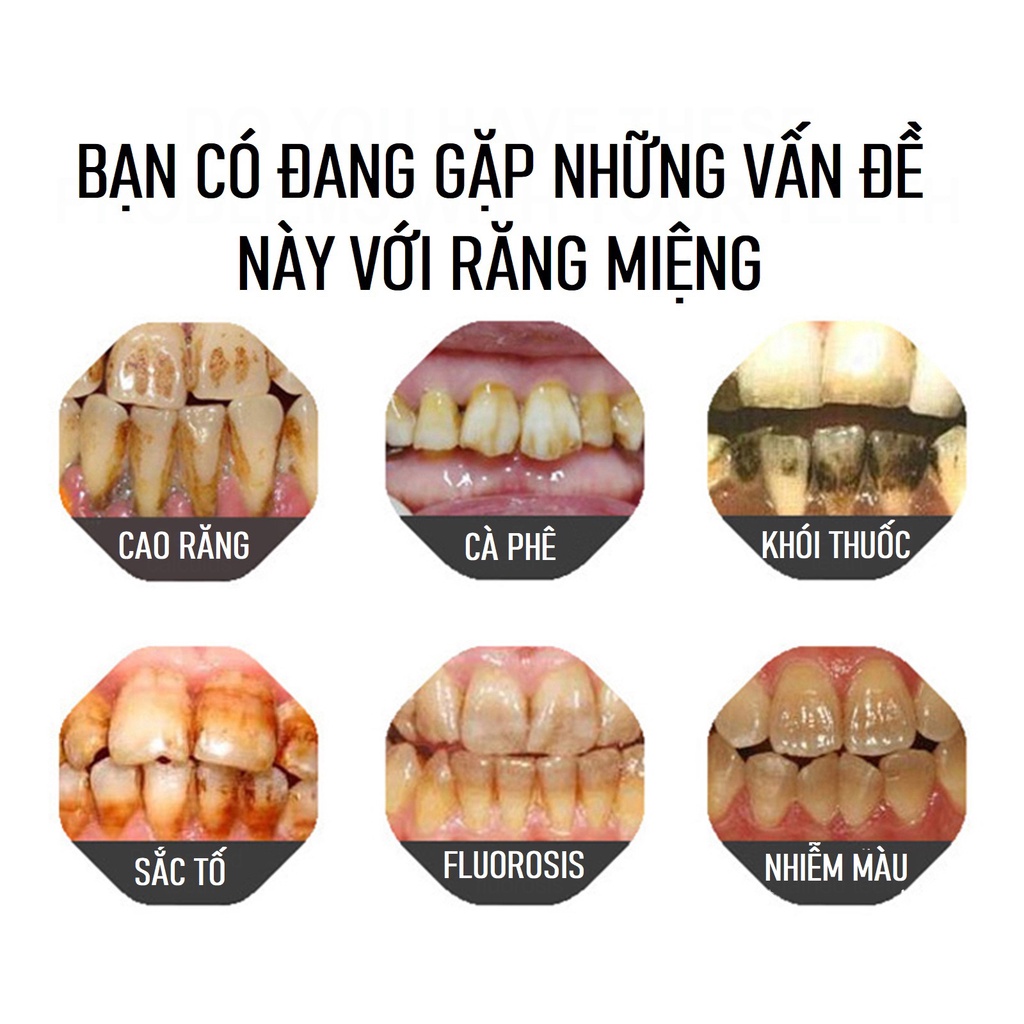 Sơn Làm Trắng Sáng Răng Tức Thì TOOTH PAINT Loại Bỏ Vi Khuẩn Mảng Bám Tích Tụ Lâu Ngày Do Khói Thuốc Cà Phê Giúp Hơi Thở