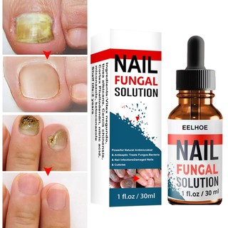 Serum Đánh Bay Nấm Móng Tay Chân Tái Tạo Móng Chắc Khỏe Sáng Bóng