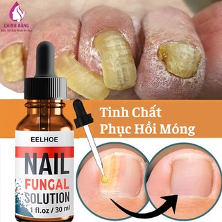Serum Đánh Bay Nấm Móng Tay Chân Tái Tạo Móng Chắc Khỏe Sáng Bóng