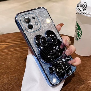 ốp lưng xiaomi 11 lite 11t 11t pro 11 Ốp Điện Thoại Silicon Mềm Mạ Điện Họa Tiết Thỏ Lấp Lánh Chống Rơi Cho xiaomi 11 lite 11t 11t pro 11