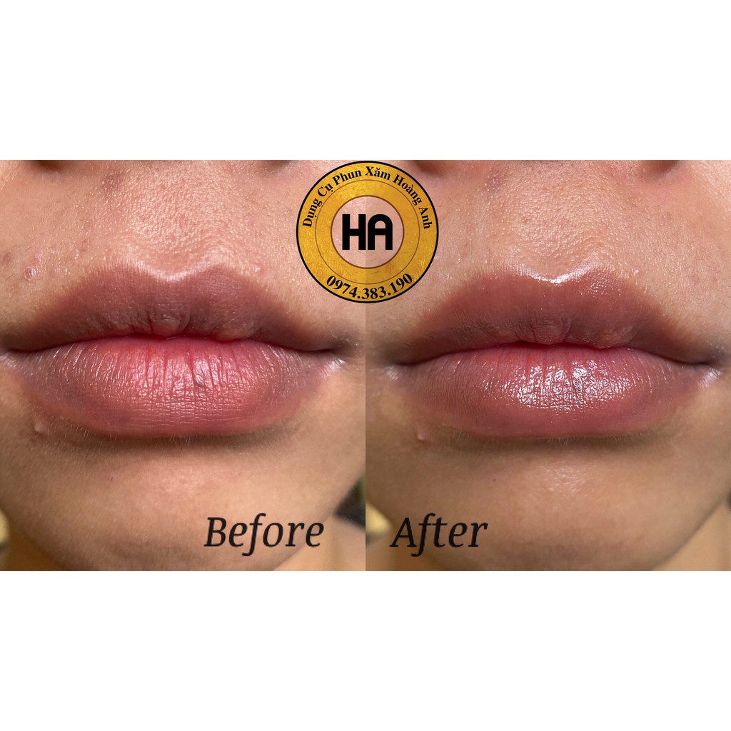 PXTM SERUM MỸ HƯƠNG 24H| DCPXHOANGANH
