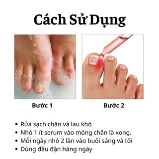 Serum Đánh Bay Nấm Móng Tay Chân Tái Tạo Móng Chắc Khỏe Sáng Bóng