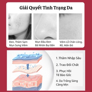 Tinh chất Zhensha Hết Mụn Se Khít Lỗ Chân Lông Da Căng Bóng Mịn Màng Sau 7 Ngày