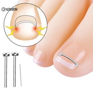 Dụng Cụ Chỉnh Hình Móng Chân Mọc Ngược Chuyên Nghiệp