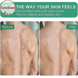 Csndices Tẩy Tế Bào Chết Găng Tay Tẩy Tế Bào Chết Da Mặt Găng Tay Massage Bền Nhiều Màu Cơ Thể Làm Sạch Sâu Khăn Cho Tắm VN