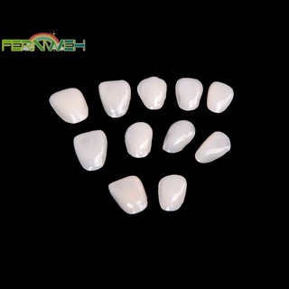 Fernweh 50 Miếng Dán Siêu Mỏng Nhựa Veneers Trước Răng Sứ, Phim Dán Răng Mới