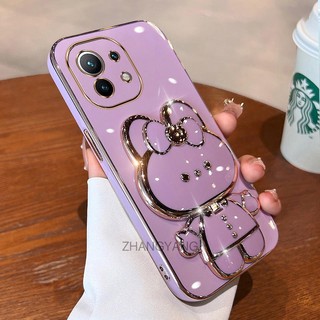 ốp lưng xiaomi 11 11 lite 11t Ốp Điện Thoại TPU Silicon Mềm Mạ Điện Gắn Gương Trang Điểm Hình Thỏ 3D Cho xiaomi 11 11 lite 11t
