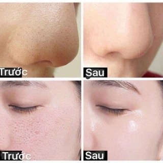 Sữa Rửa Mặt Giảm Nám Chống Tàn Nhang Thảo Dược JOMTAM Da Trắng Sáng Và Dưỡng Ẩm